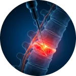 Dr. Leonardo Yukio | Especialista em Cirurgia de Coluna