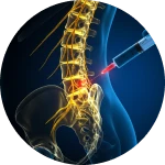 Dr. Leonardo Yukio | Especialista em Cirurgia de Coluna